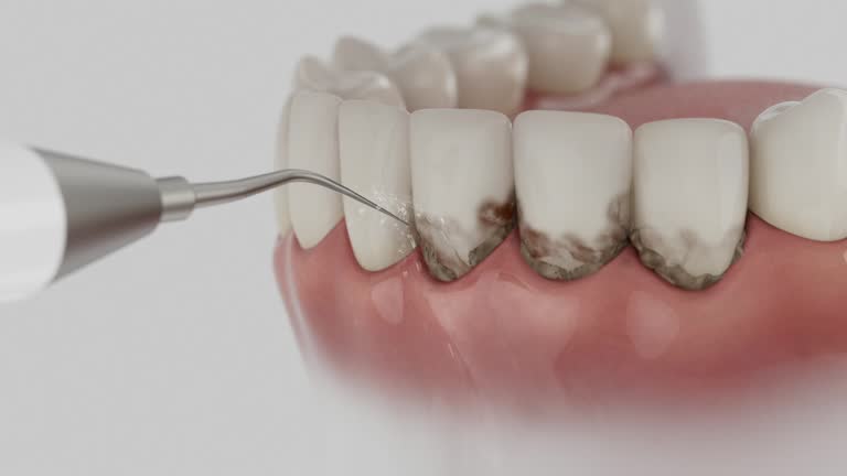 Trusted Teeth Cleaning And Checkup service in Basehor, KS - Dentist Open Now